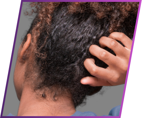 Image of itchiness symptom